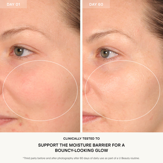 The BARRIER Bioactive Treatment