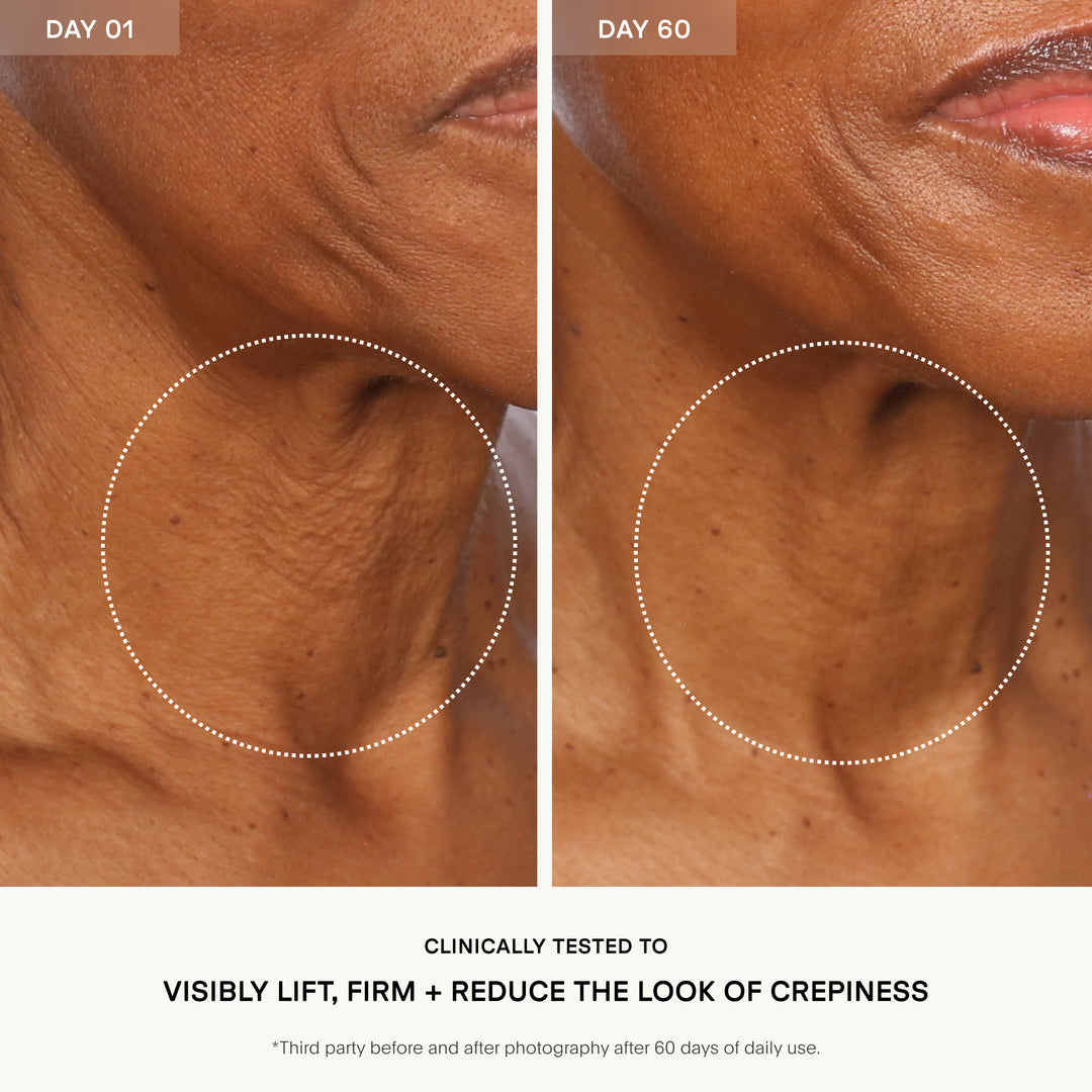 The SCULPT Neck + Décolleté