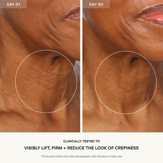 The SCULPT Neck + Décolleté
